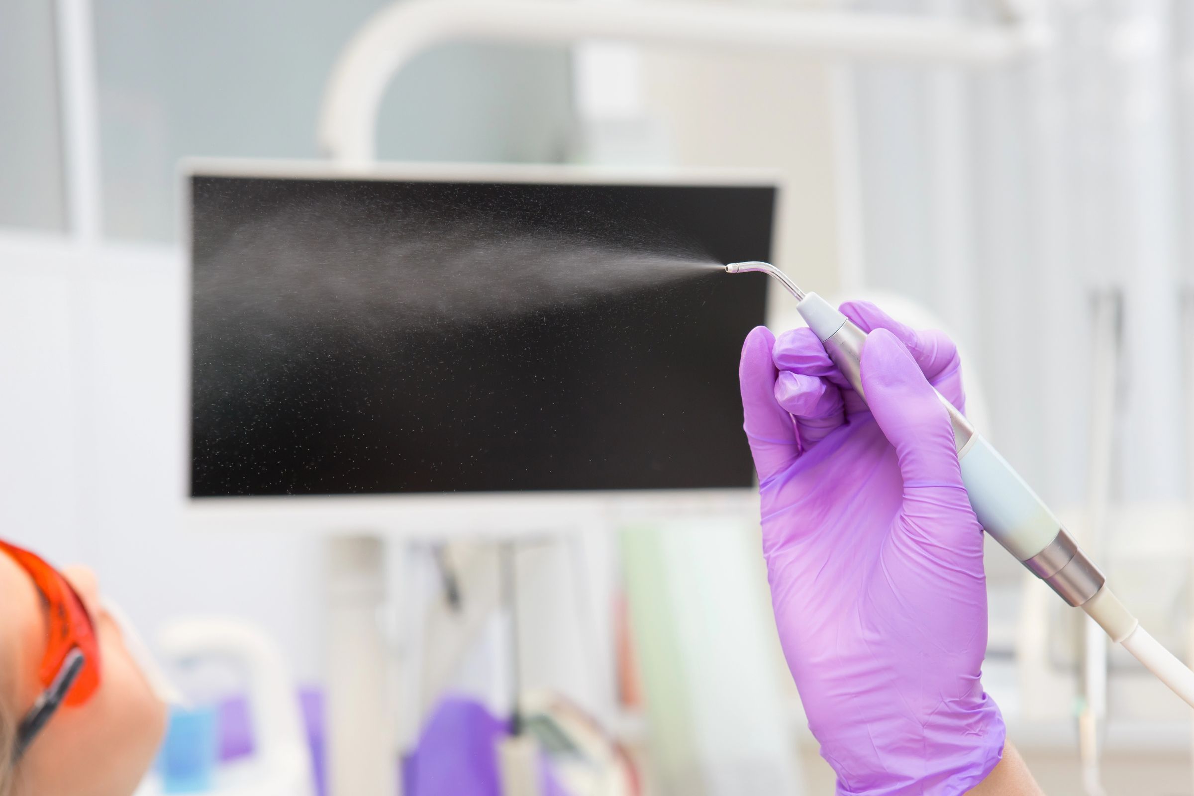 Ce este Guided Biofilm Therapy (GBT)?