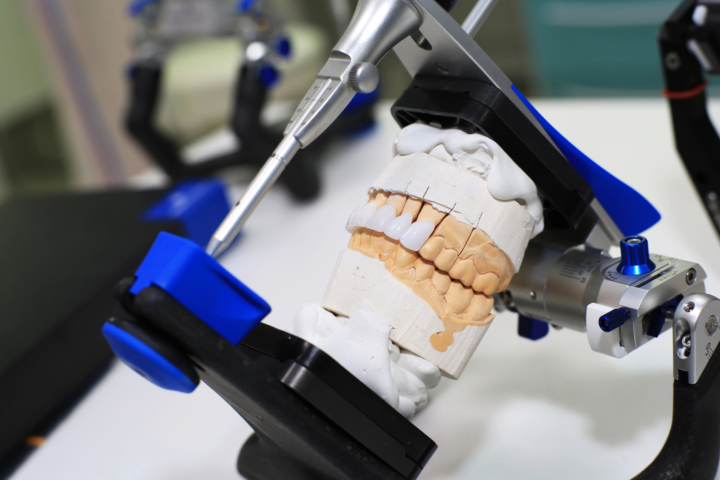 Arta din spatele unui zâmbet perfect: tehnicienii dentari în care avem deplină încredere